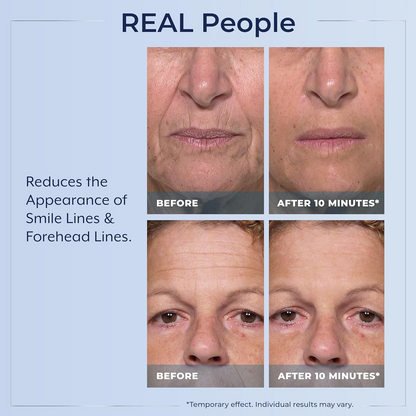 Plexaderm Rapid Reduction Eye Serum - Visibly Reduces Under-Eye Bags, Wrinkles, Dark Circles, Fine Lines & Crow's Feet Instantly, Anti Aging Wrinkle Remover for Face, Full Size Tube