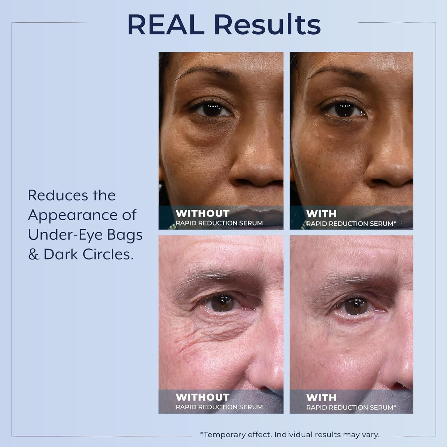 Plexaderm Rapid Reduction Eye Serum - Visibly Reduces Under-Eye Bags, Wrinkles, Dark Circles, Anti Aging Wrinkle Remover for Face, Pump