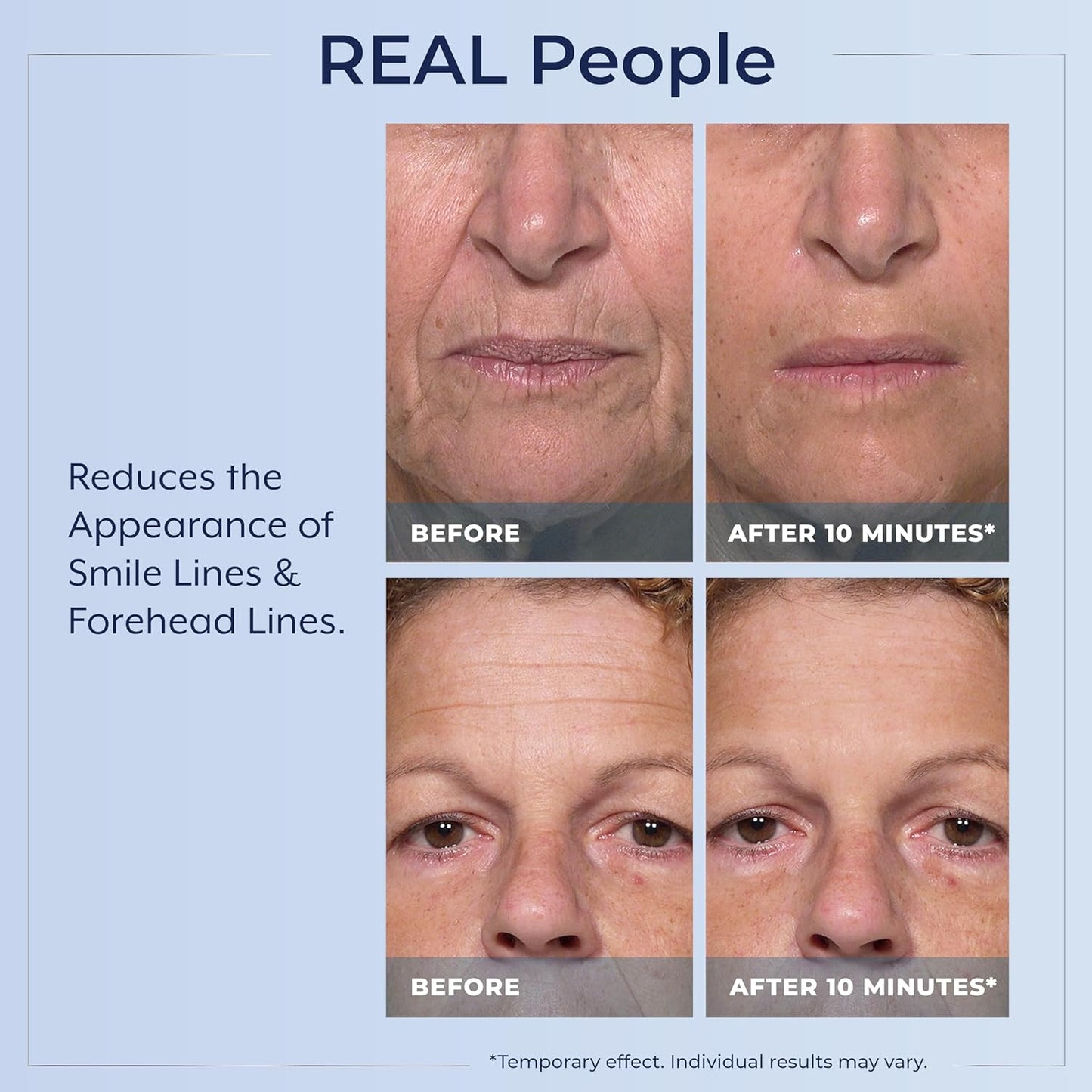 Plexaderm Rapid Reduction Eye Serum - Visibly Reduces Under-Eye Bags, Wrinkles, Dark Circles, Anti Aging Wrinkle Remover for Face, Pump